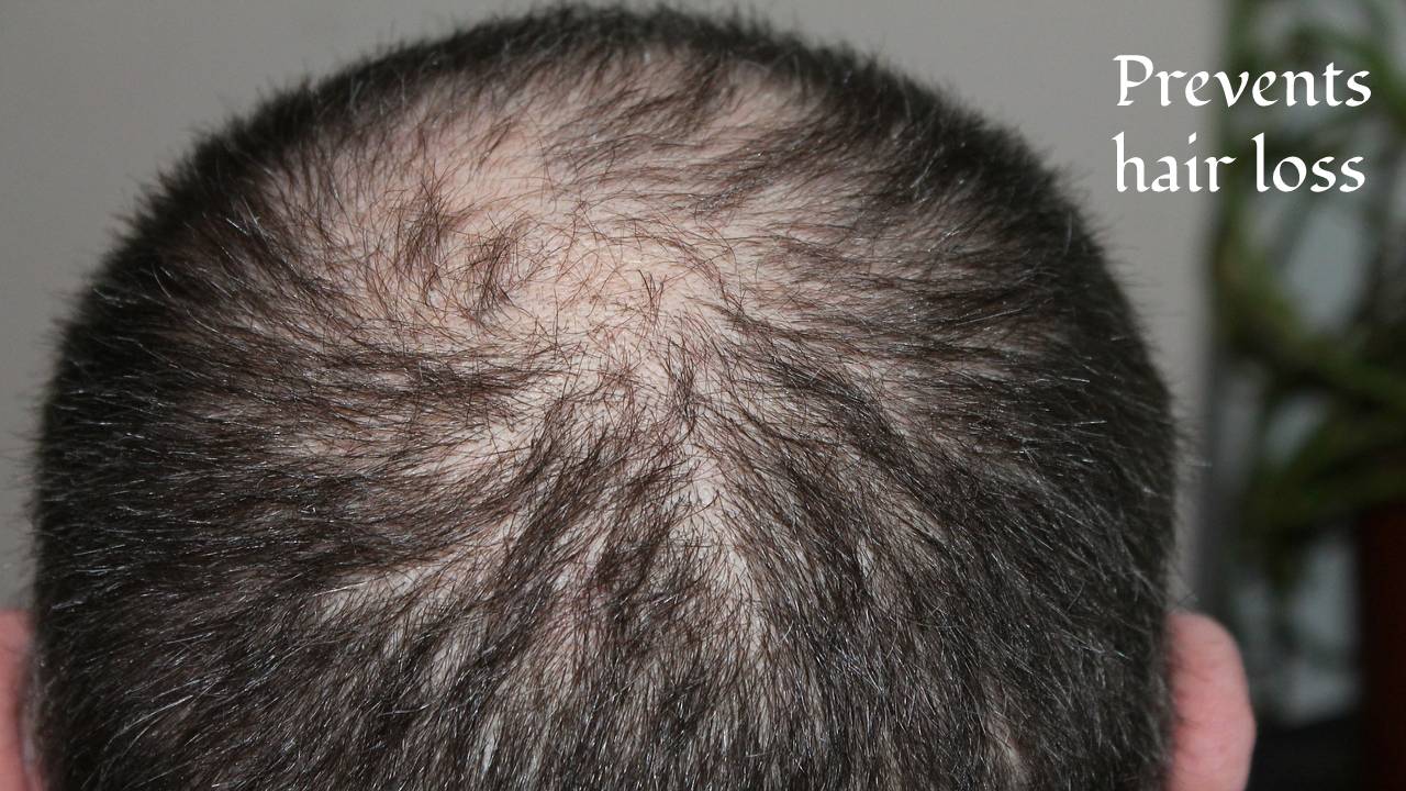 Prevent hair loss