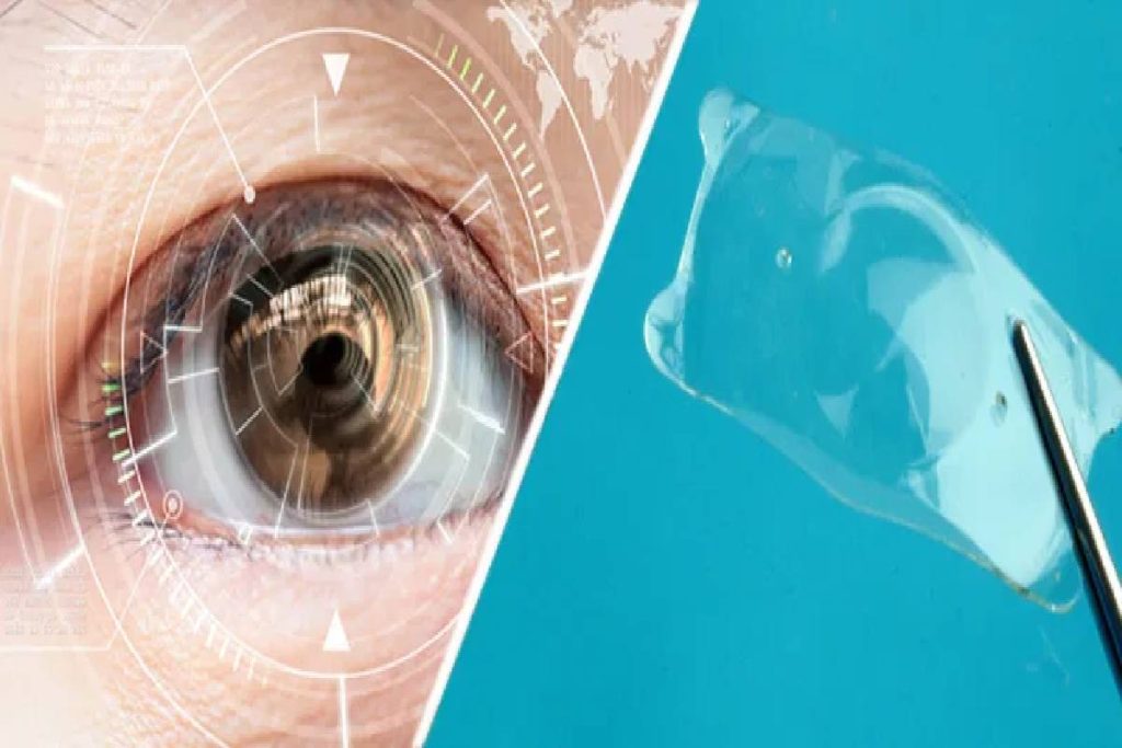 Implantable Contact Lens Surgery_ A Modern Alternative to LASIK for Myopia and Hyperopia Correction